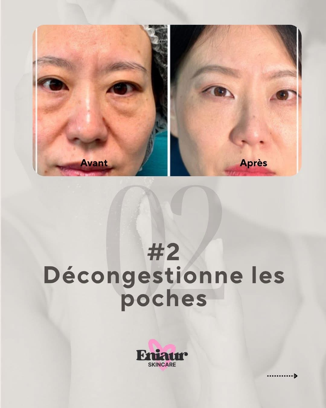 🌟 Crème Contour des Yeux